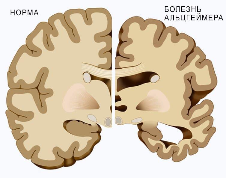 Заголовок